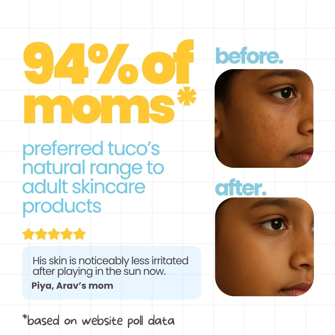 4-in-1 Dull Skin Kit for Kids: Face Wash + Soap + Sunscreen + Lotion - Image 6