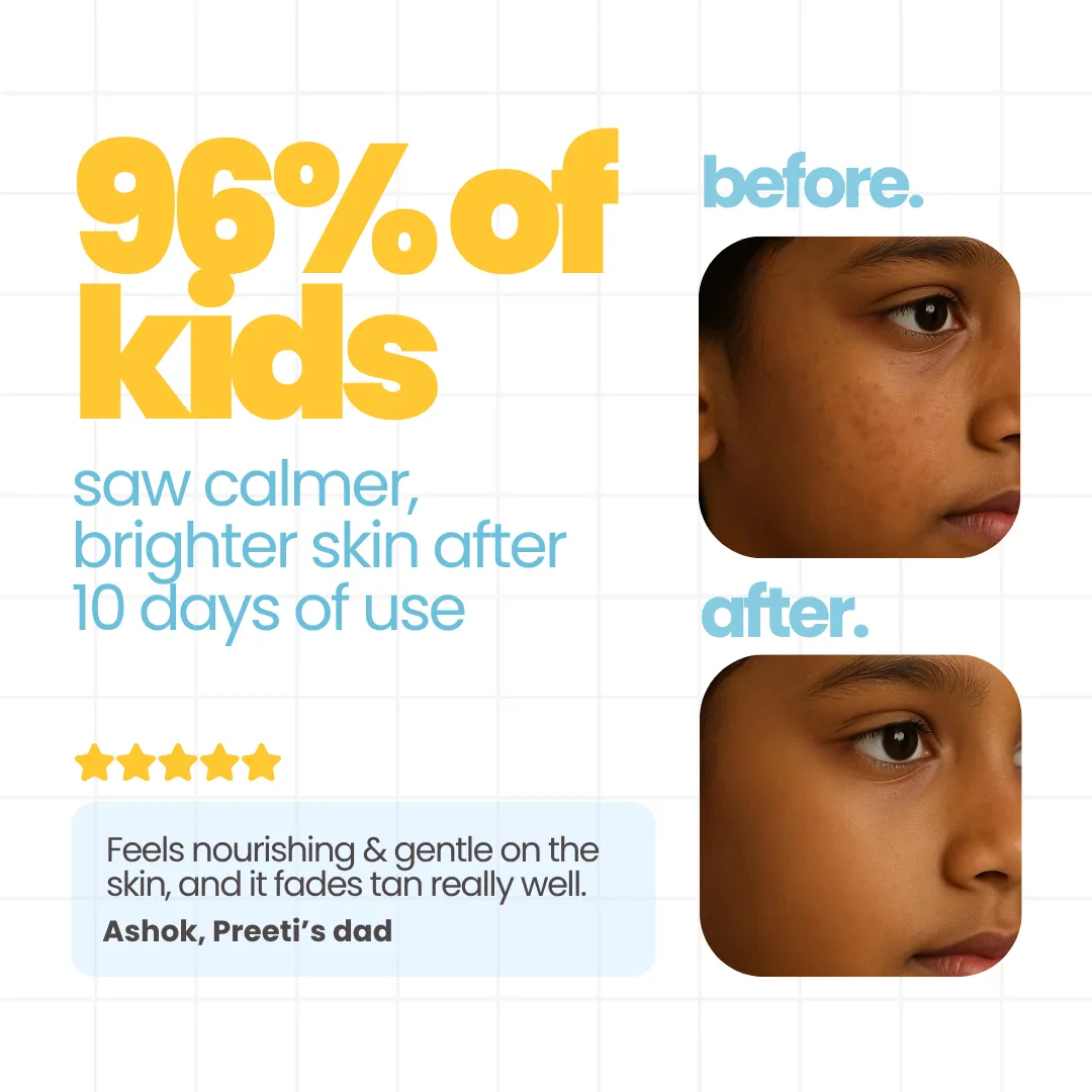 Dull Skin Kit: Soap + Lotion 100ml + Sunscreen SPF 50! - Image 7